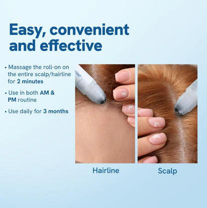 Ocuvana™ Advanced Hair Growth Roll-On Serum