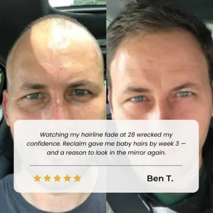 Ocuvana™ Advanced Hair Growth Roll-On Serum